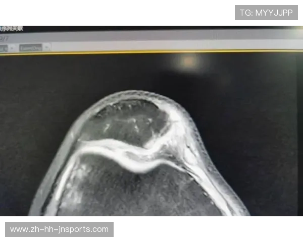 穆迪遭遇膝盖变形重伤无对抗下突发伤情致比赛转播信号中断